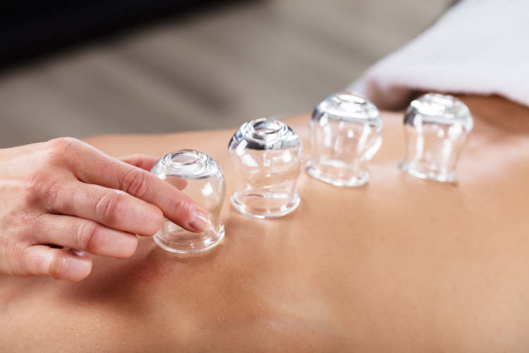 Cupping Massage Example